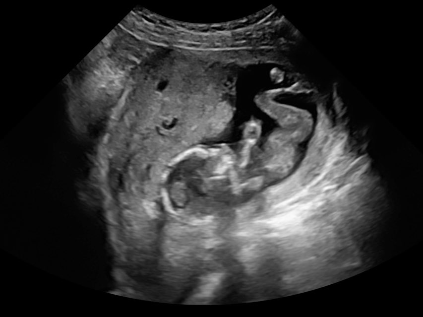 @0xHirsch #1921678552157593881